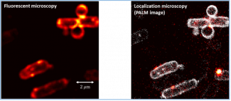 Image de bactérie par microscopie de fluorescence